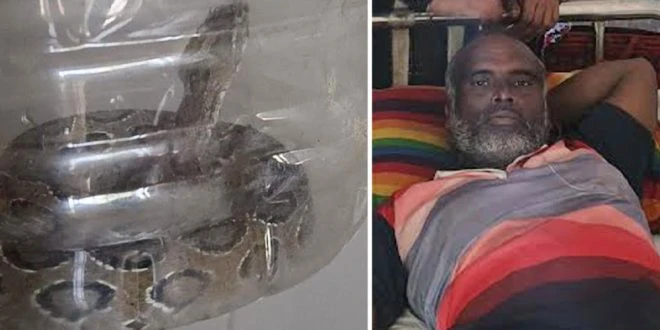 ছোবল খেয়ে জীবিত রাসেলস ভাইপার নিয়ে হাসপাতালে কৃষক